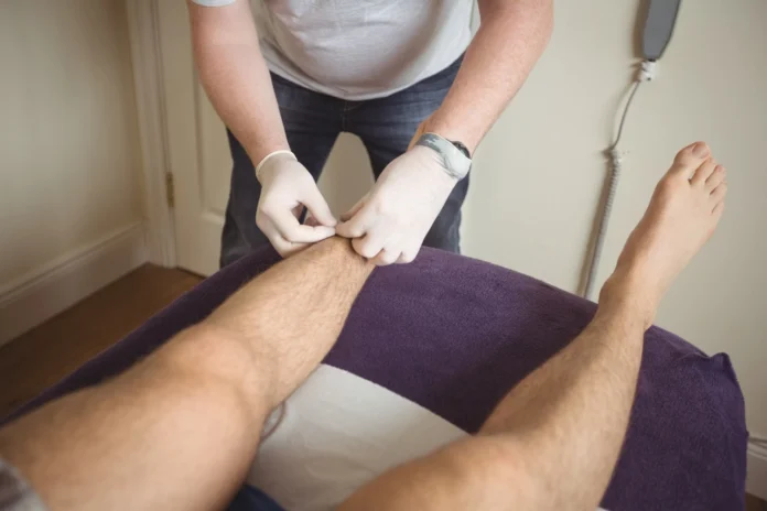 Varicose Vein